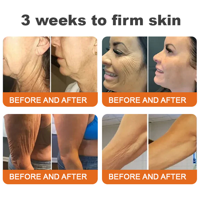 Made and Shipped from USA✨TLOPA® Botox Bee Venom Firming Serum Stick(🔥LAST DAY 70% OFF)💄