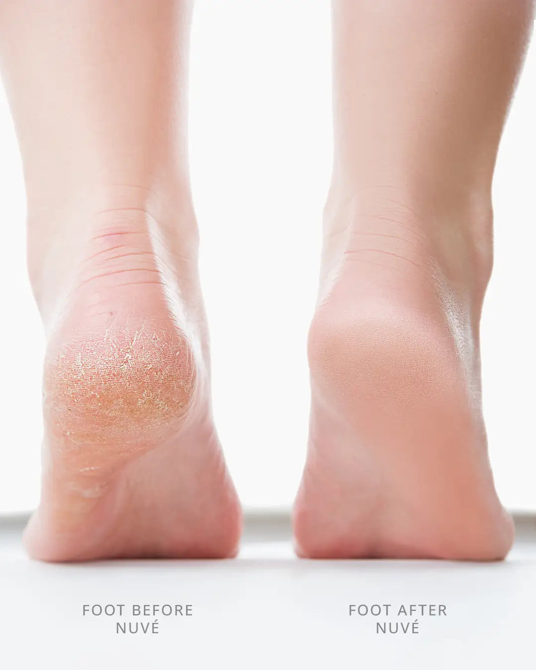 Electric Foot File Callus Remover 3 Pro
